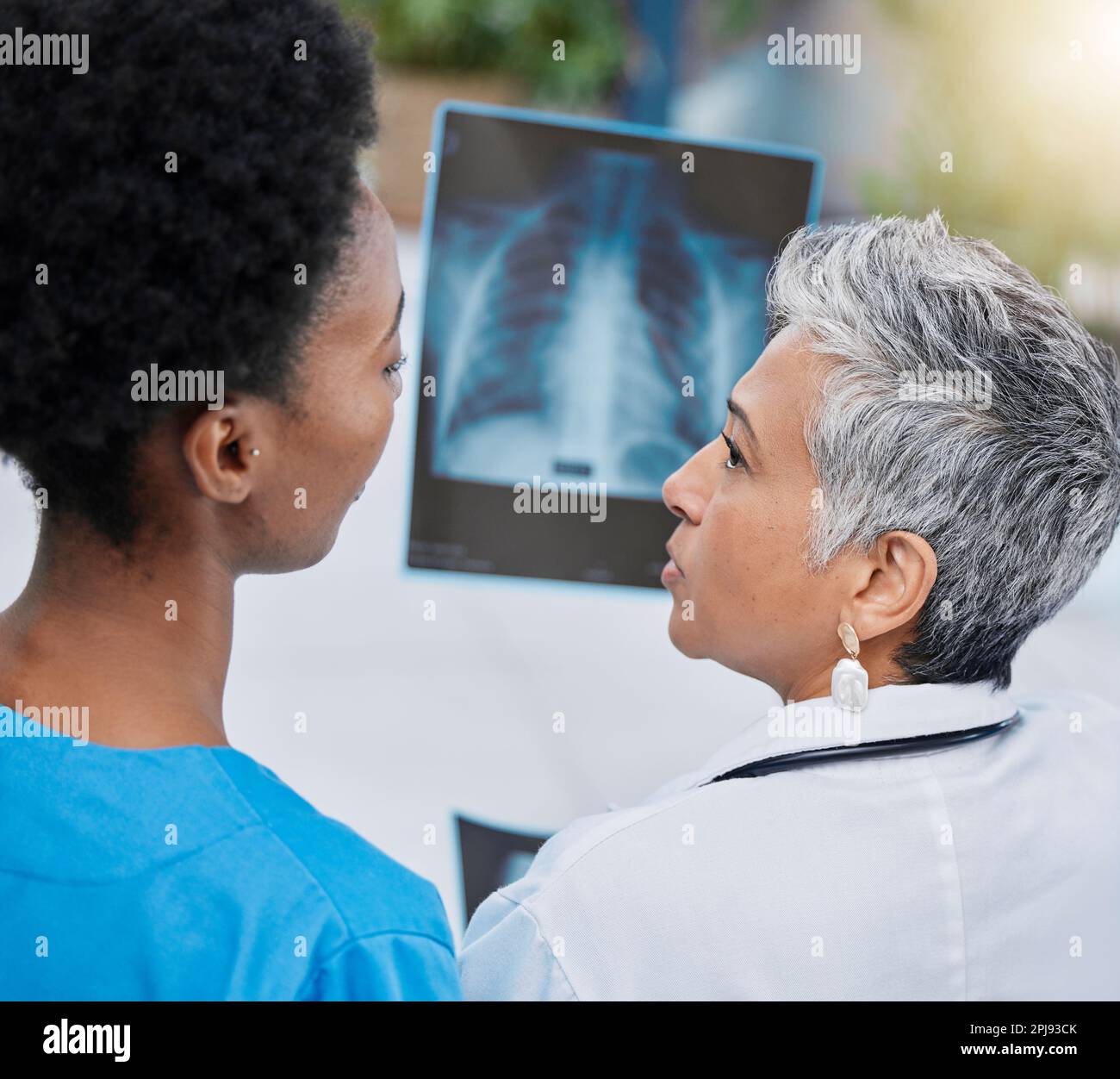X ray, senior woman analysis and doctor team with conversation and