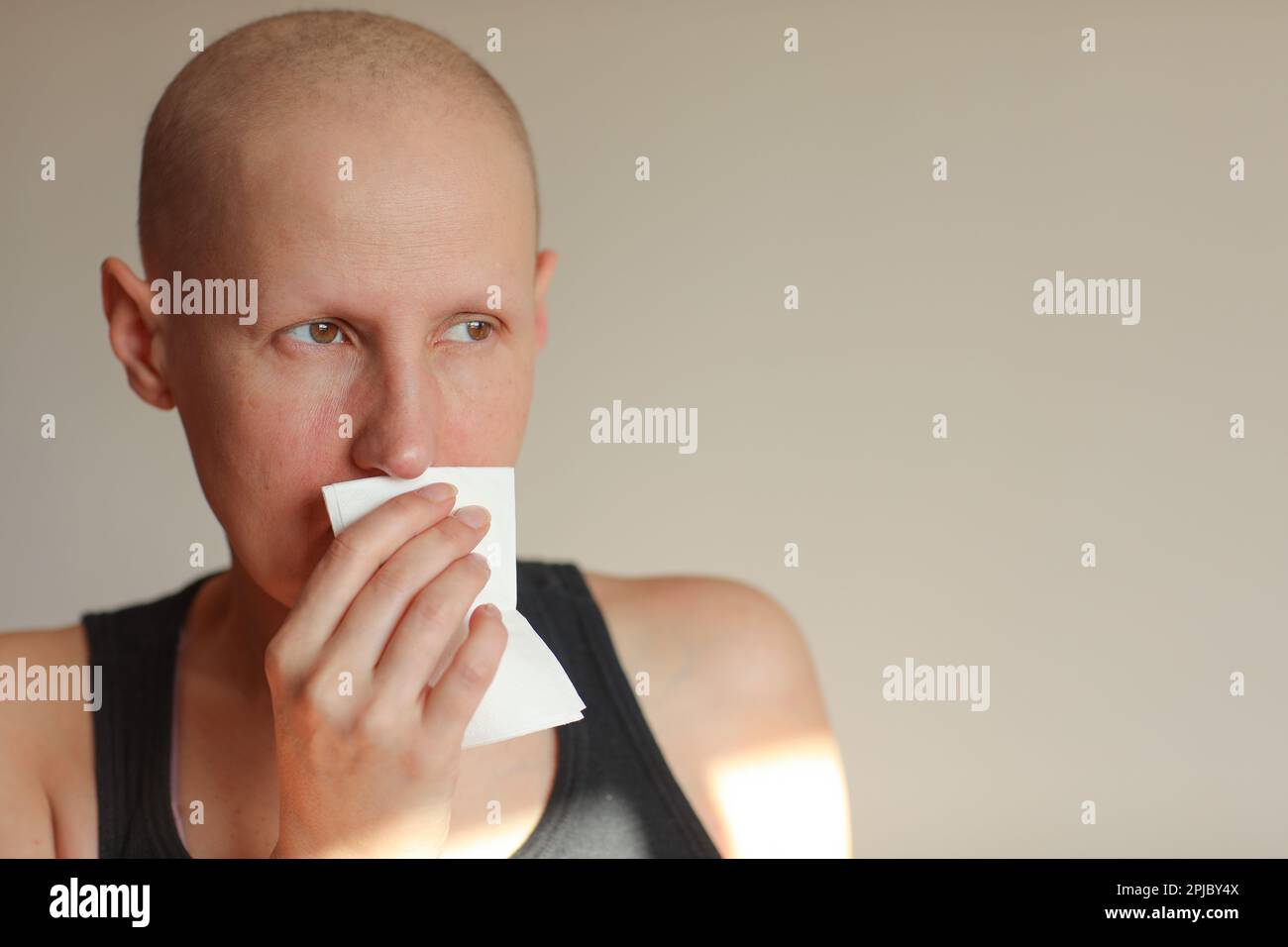 Bald cancer sick woman blowing running nose got flu cough cold