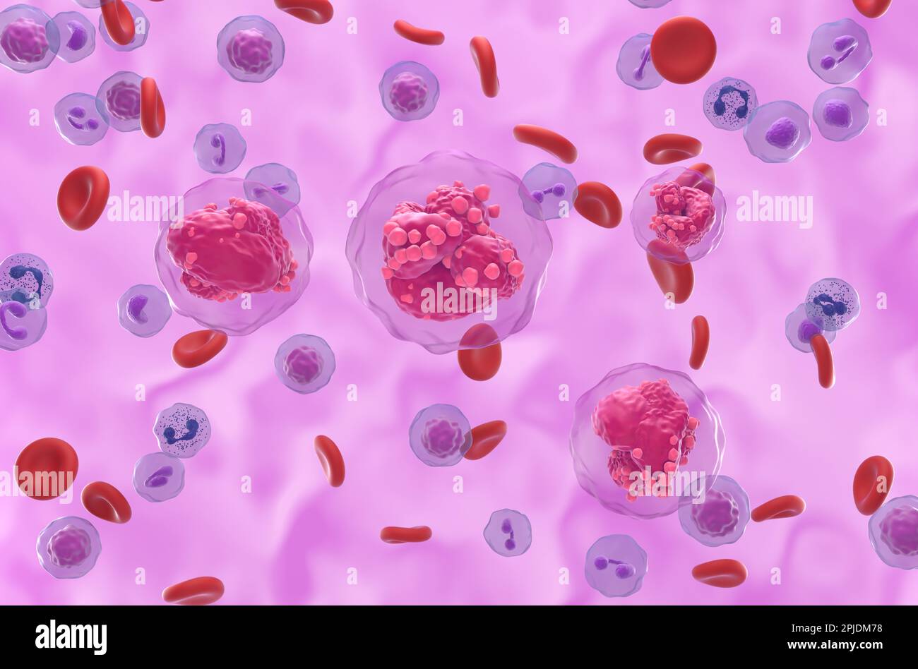 Acute lymphoblastic leukemia (ALL) cancer cells in the blood flow - isometric view 3d illustration Stock Photo