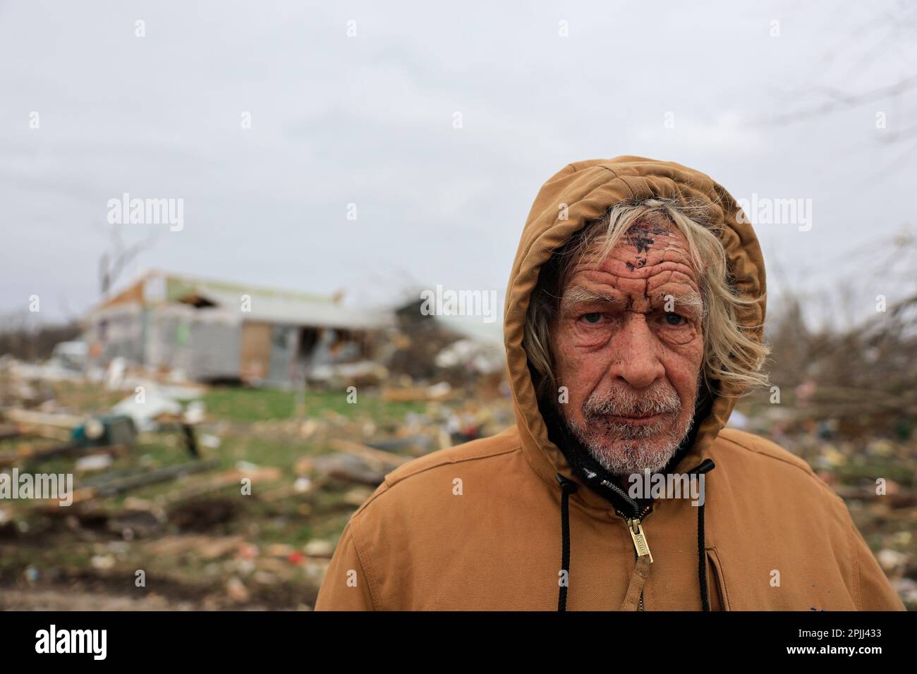 SULLIVAN, INDIANA - APRIL 1: Calvin Cox, who said he doesn't have  homeowners insurance, lost his home, his vehicles, and got injured by glass  during a tornado on April 1, 2023 in