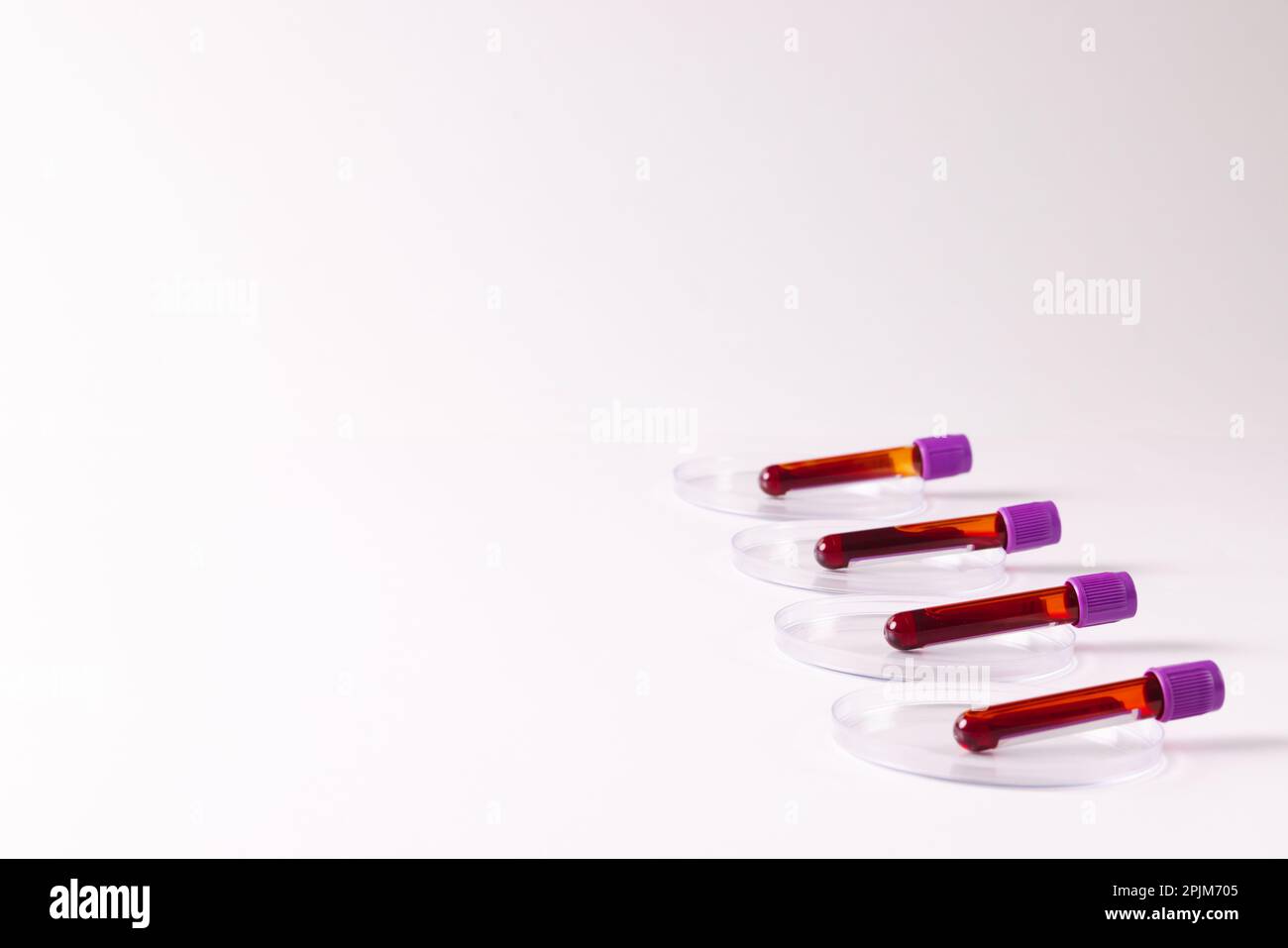 Row of blood sample tubes in petri dishes, on white background with ...