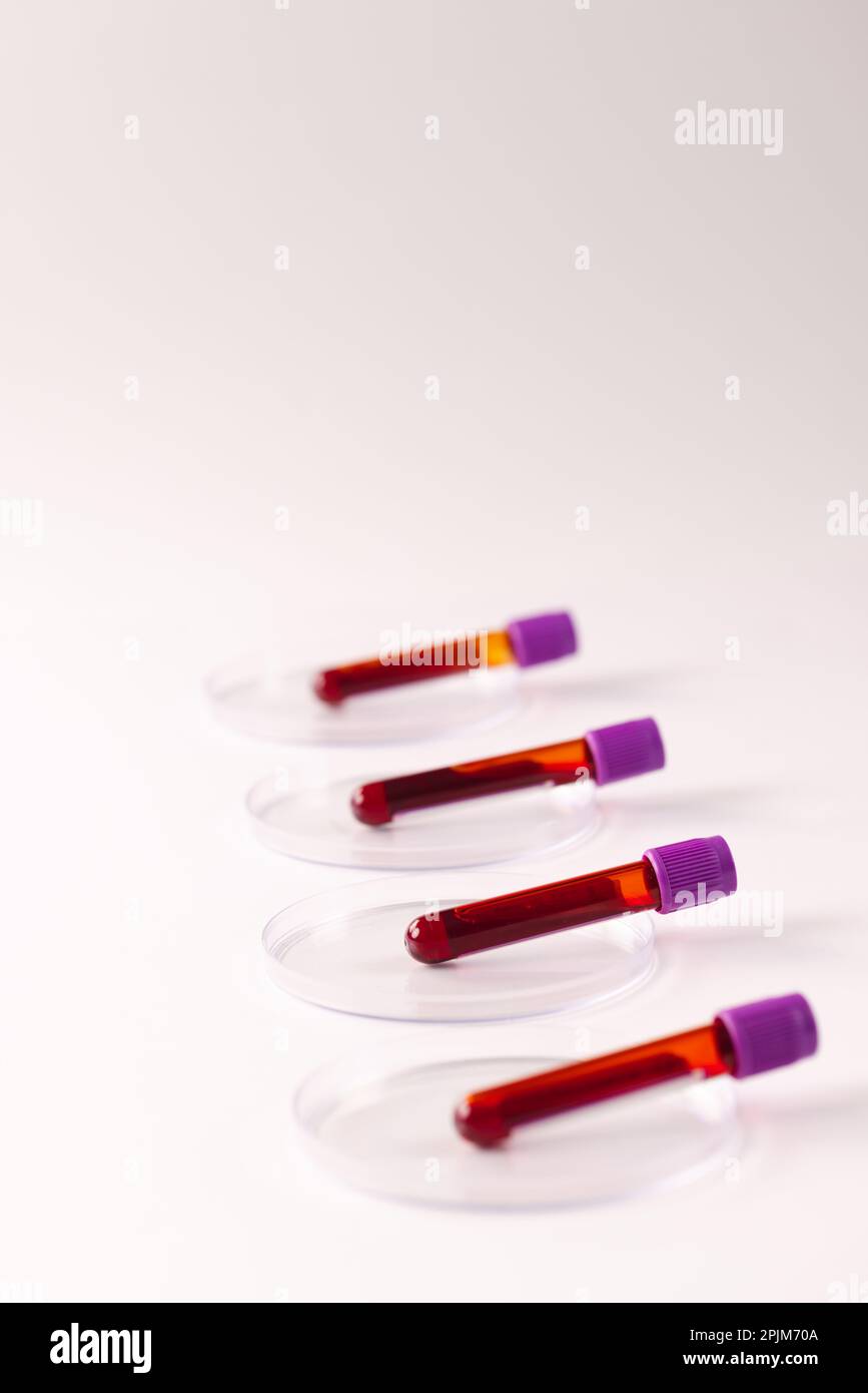 Row of blood sample tubes in petri dishes, on white background with ...