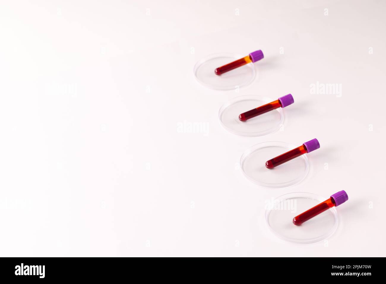 Row of blood sample tubes in petri dishes, on white background with ...