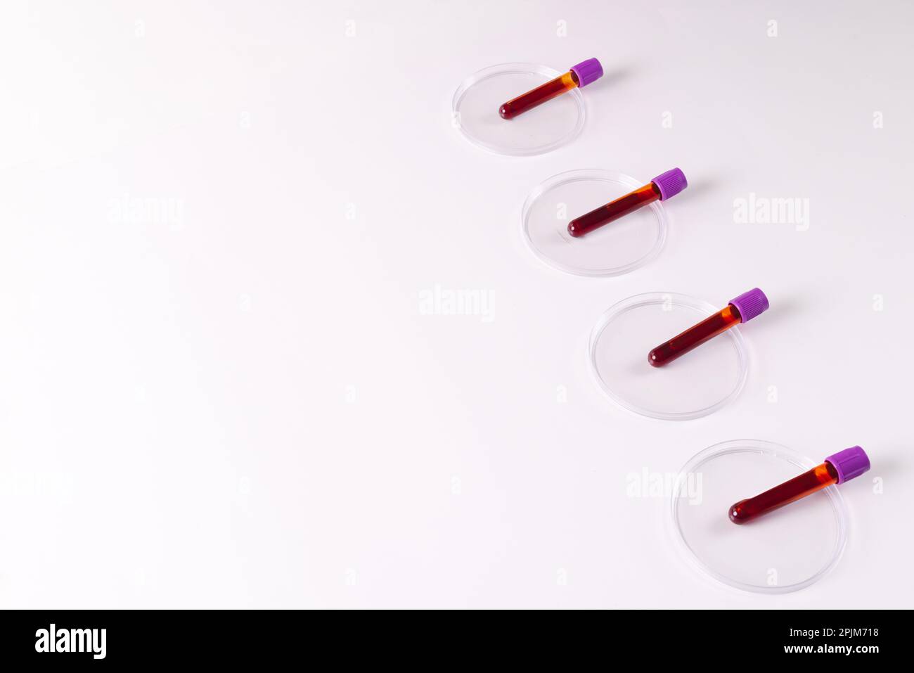 Row of blood sample tubes in petri dishes, on white background with ...