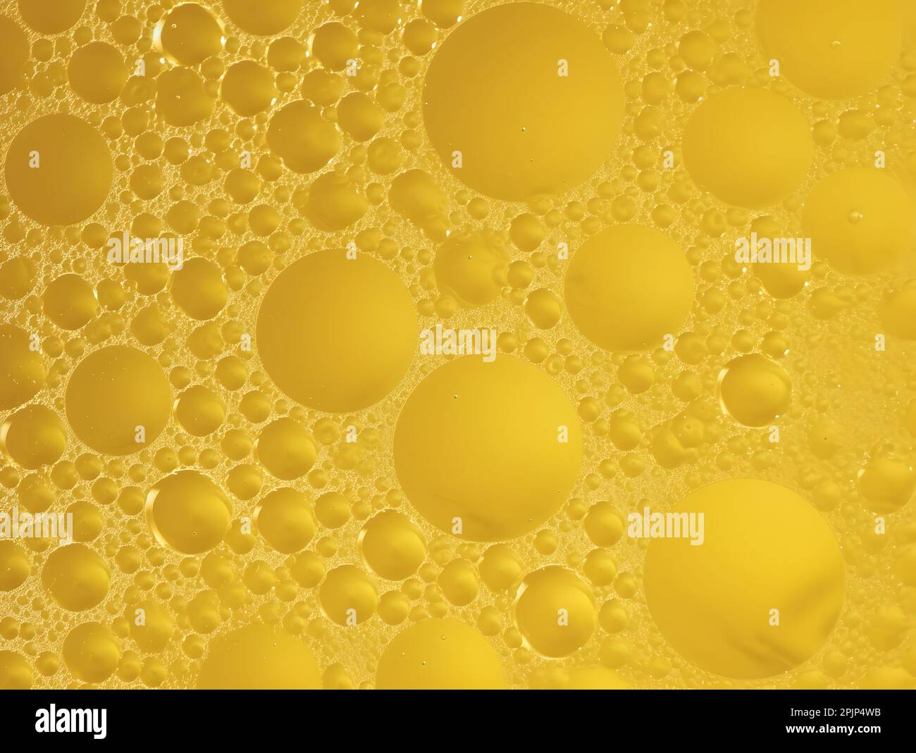 High color frothy urine with bubbles. Foamy excretion. Closeup view