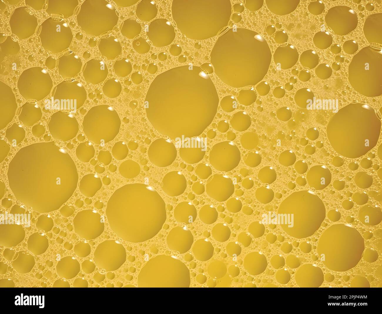 High color frothy urine with bubbles. Foamy excretion. Closeup view