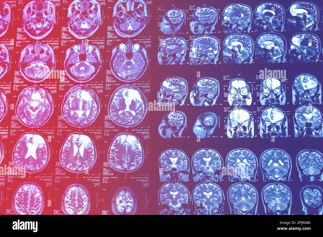 MRI scan of the brain for diagnosis. Medical examination for health