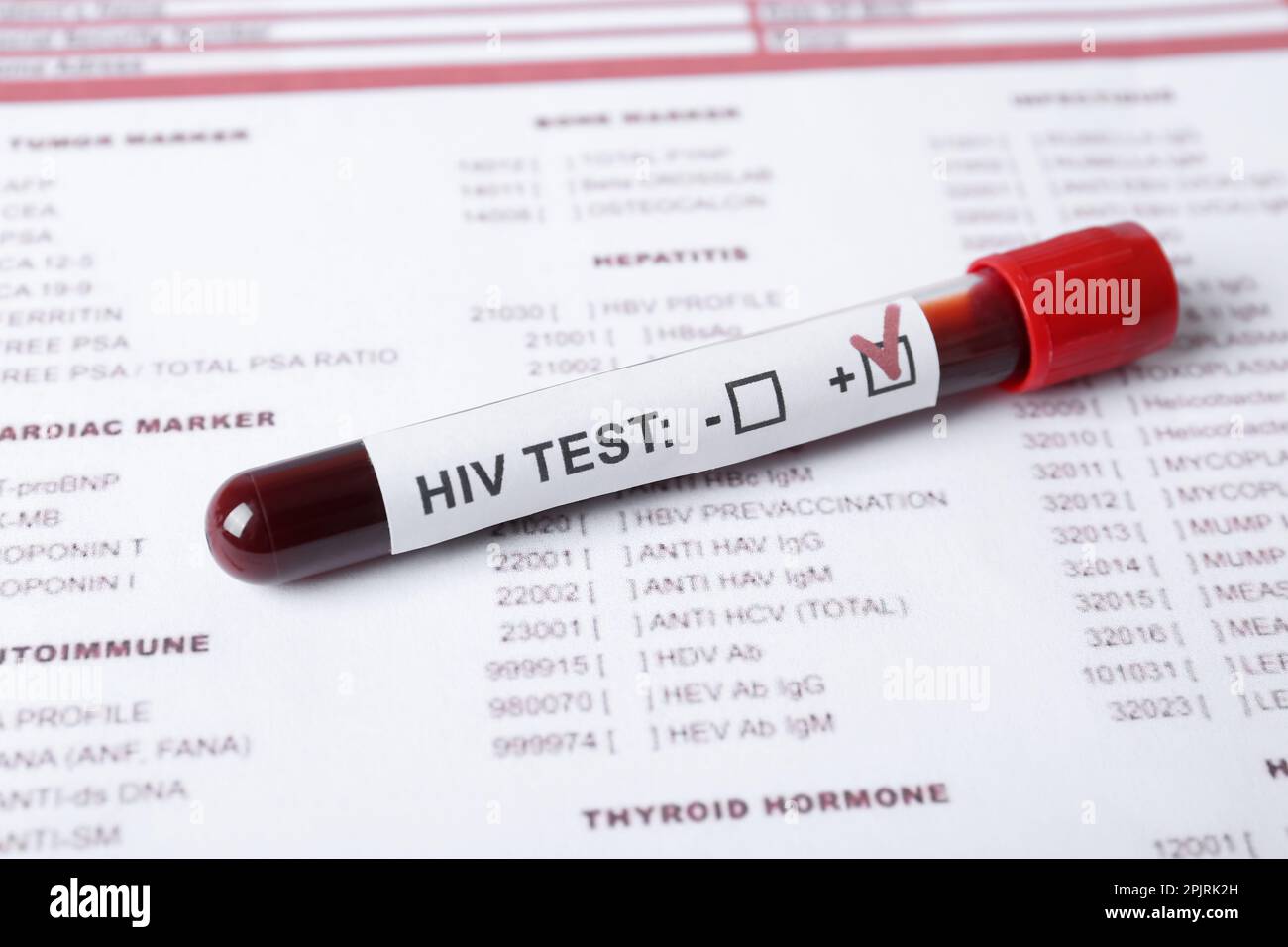 Tube with blood sample and label HIV TEST on laboratory form, closeup