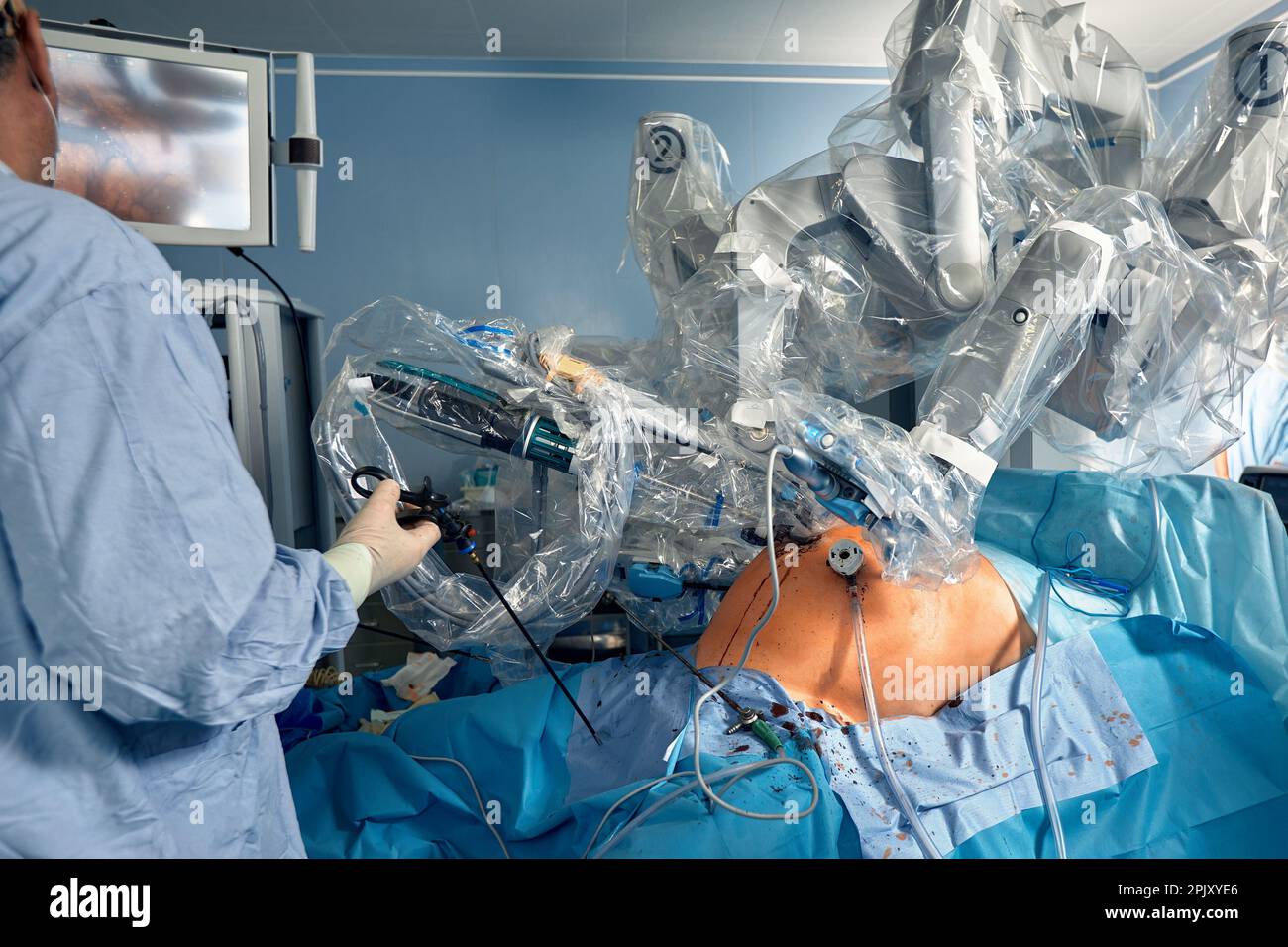 Minimal invasive robot surgical system in hospital. Robotic technology