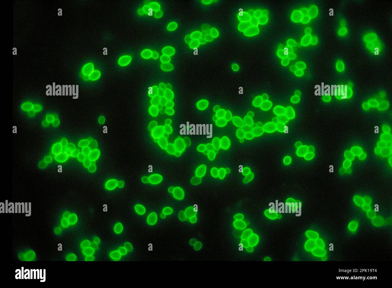 Candida albicans yeast cells, light micrograph Stock Photo - Alamy