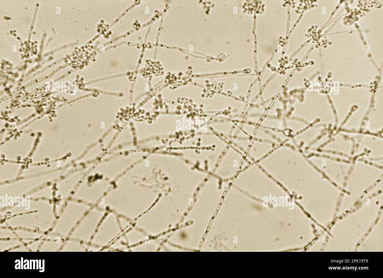 Candida albicans fungus, light micrograph Stock Photo - Alamy