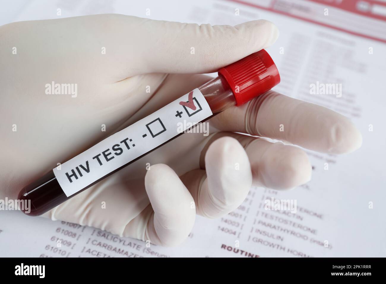 Scientist holding tube with blood sample and label HIV Test near