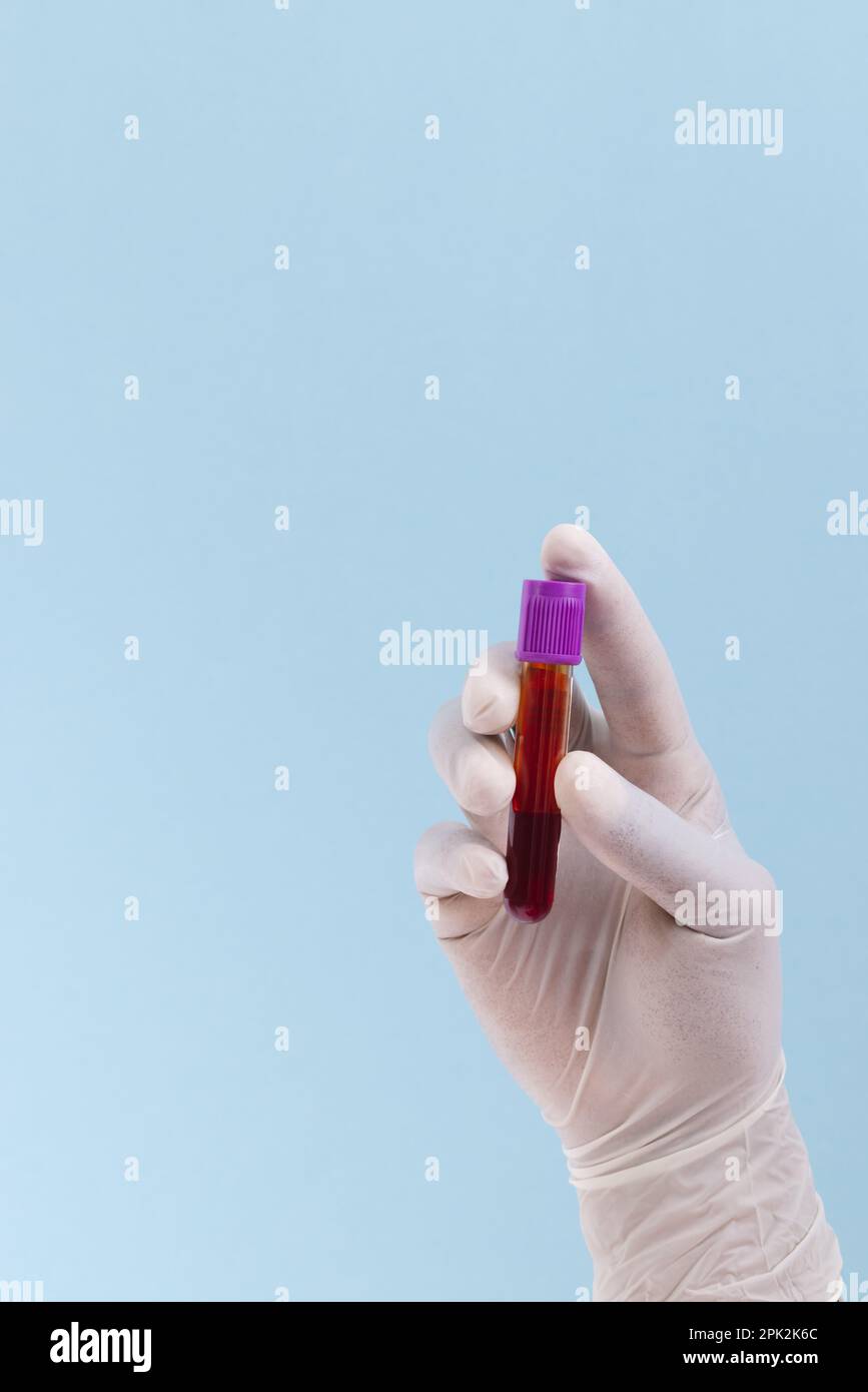 Hand in white surgical glove holding blood sample tube, on blue