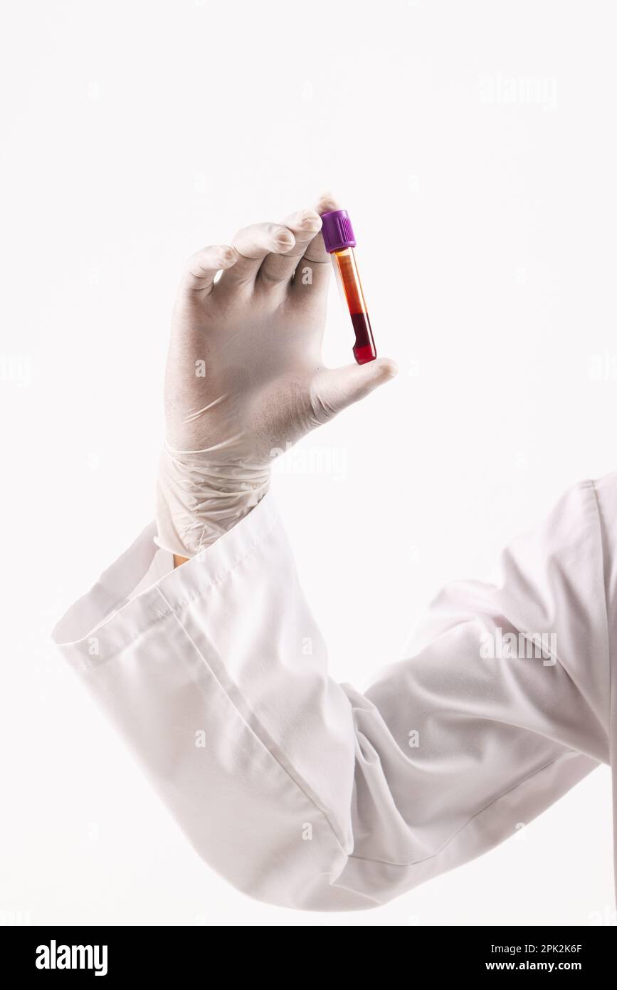 Hand in white surgical glove holding blood sample tube, on white background Stock Photo
