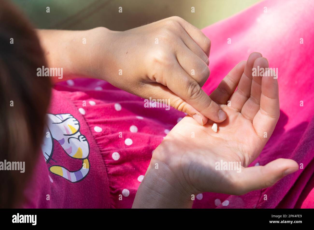 A girl holds a baby tooth that has fallen out in the palm of her hand. The child's teeth change to the molars, preschool age Stock Photo