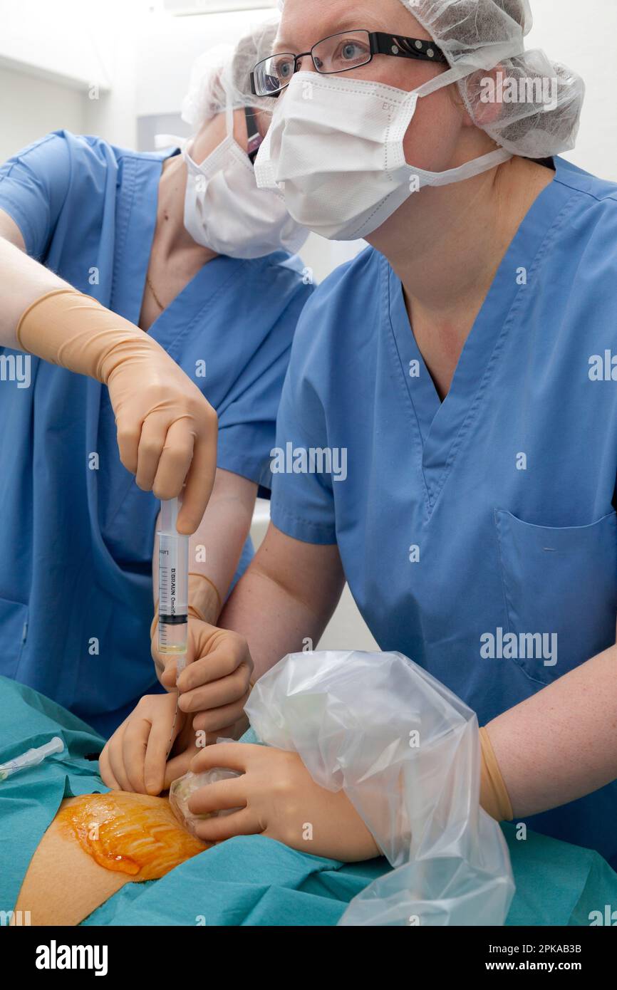 Fetal medicine amniocentesis and study of the karyotype Stock Photo Alamy
