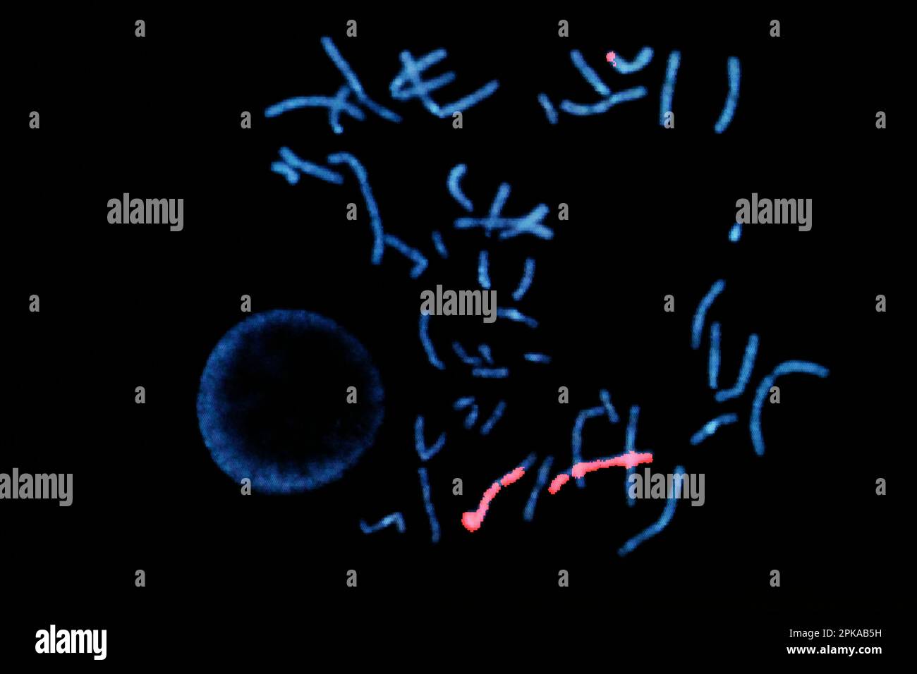 laboratory, prenatal diagnosis by medical imaging FISH