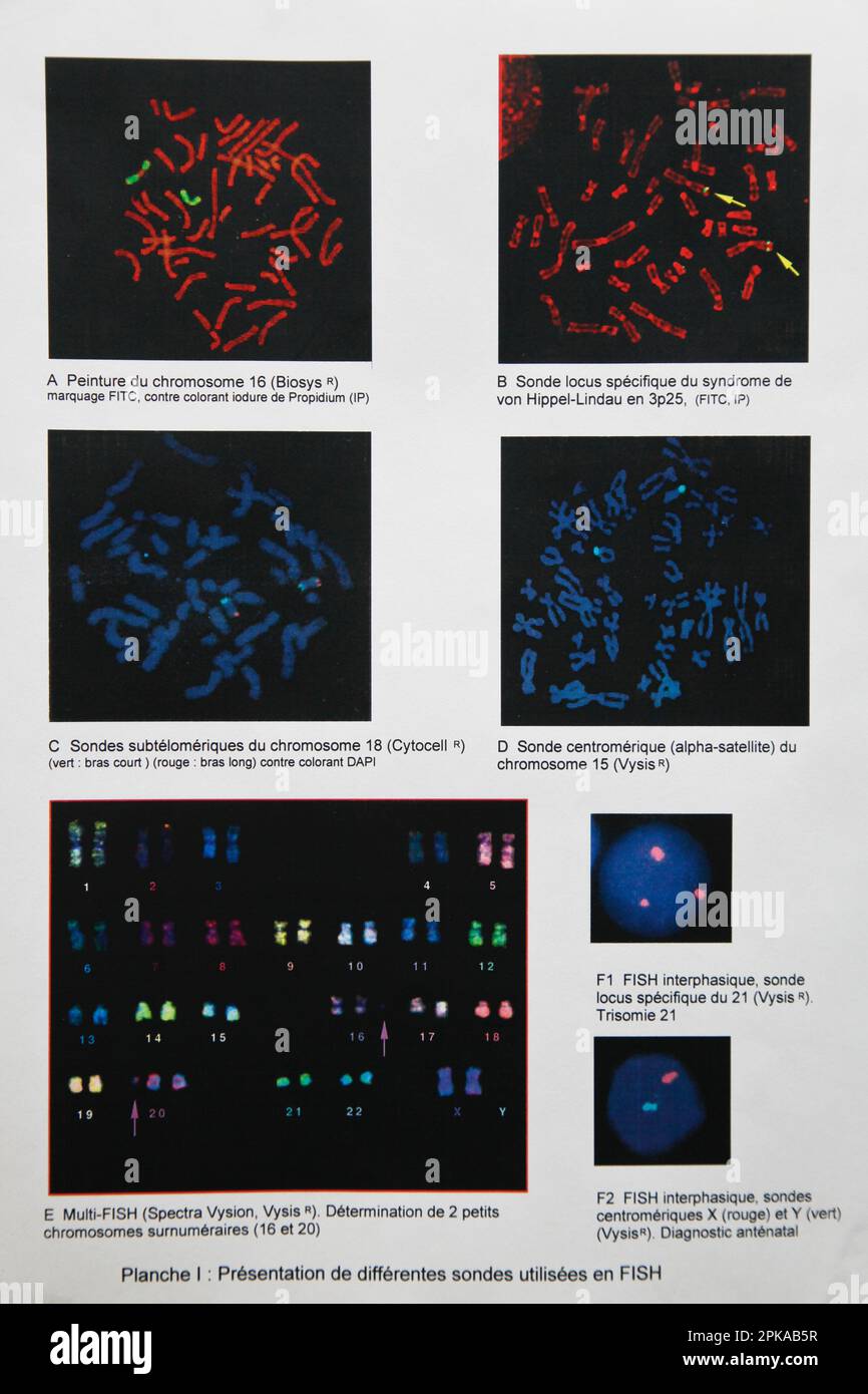 laboratory, prenatal diagnosis by medical imaging FISH