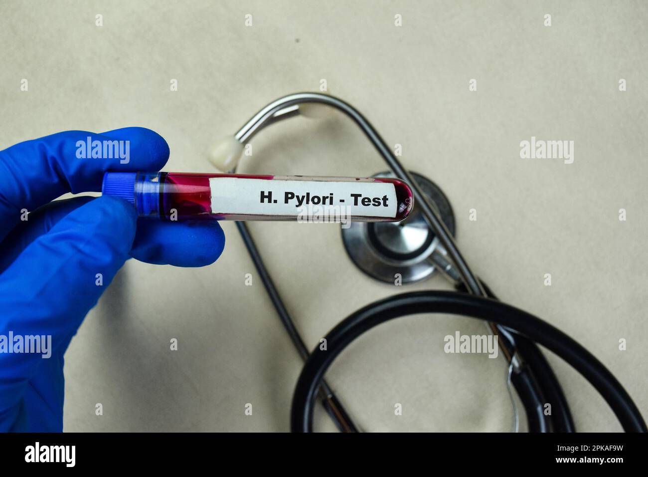 Concept of H. Pylori - Test with blood sample. Healthcare or medical concept Stock Photo