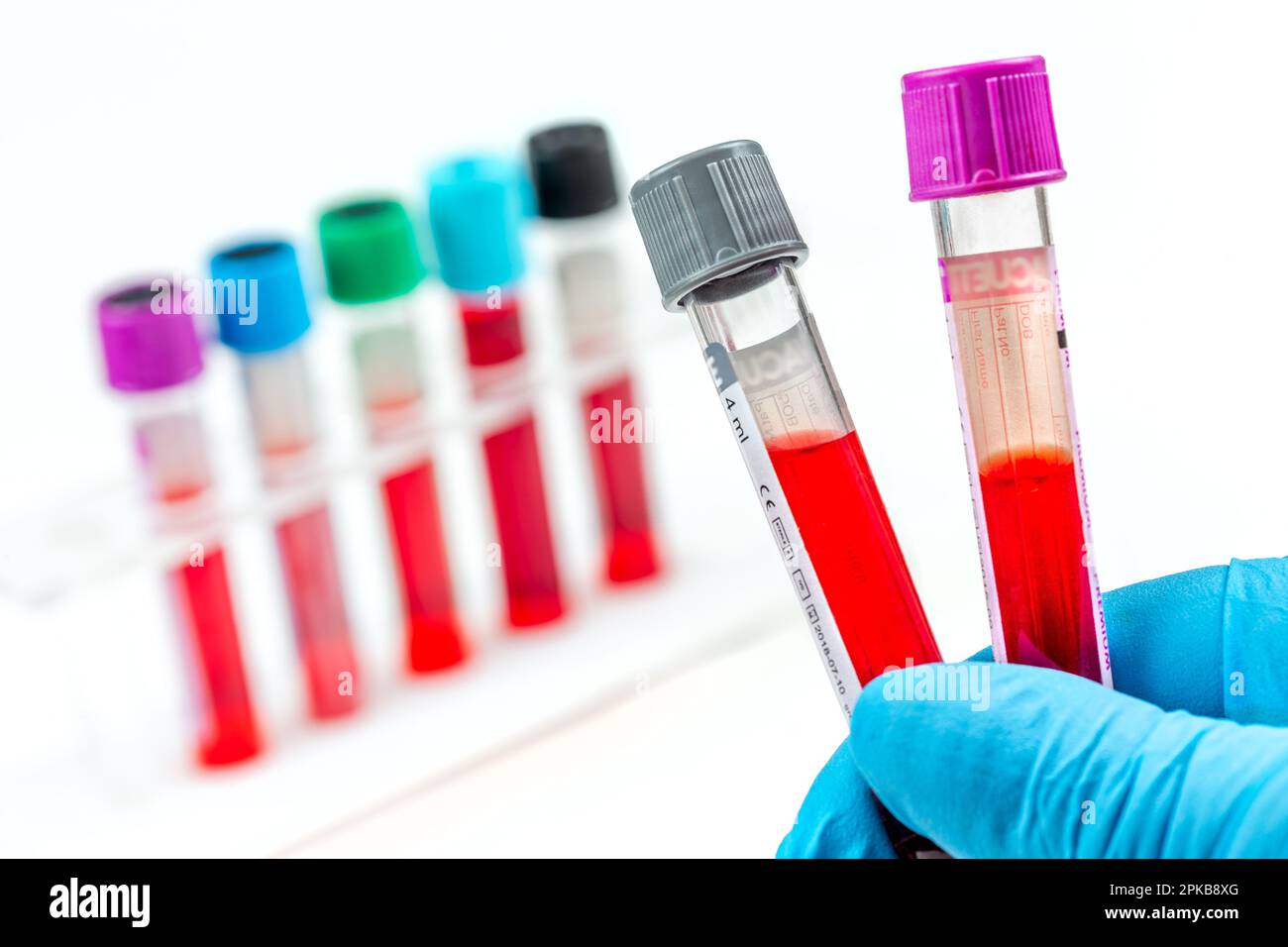 Two tubes of blood in a hand with a rack in the background Stock Photo
