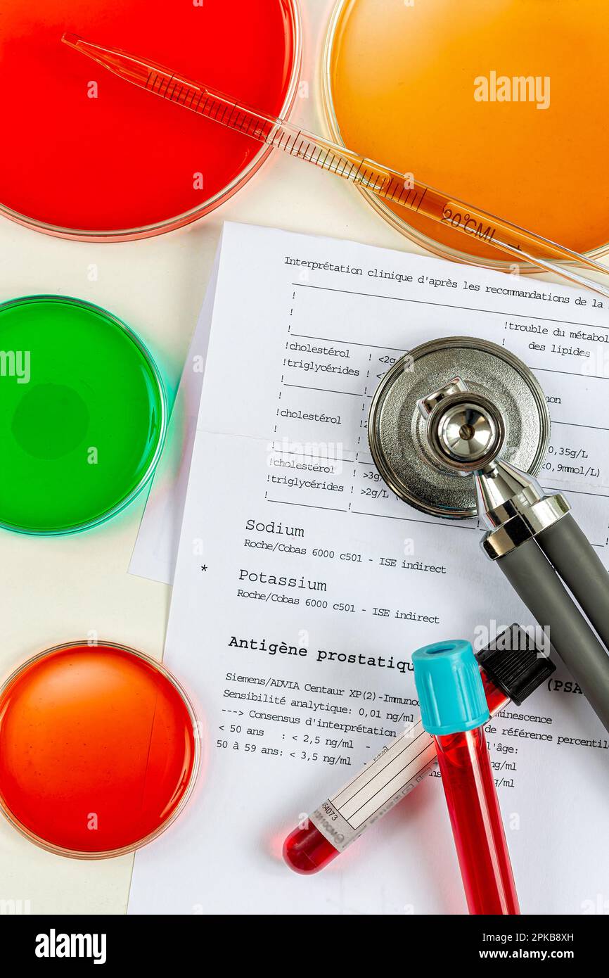 Blood tubes and stetoscope placed on test results Stock Photo Alamy