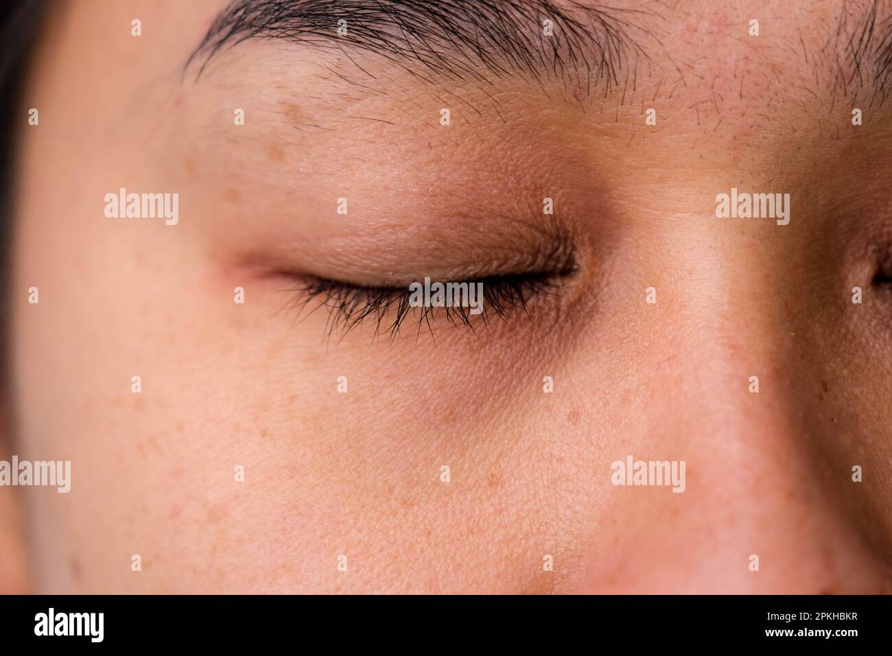 Close-up of freckles on Asian woman's face. Middle-aged woman with wrinkles, blemishes, dark spots, freckles, dry skin on her face. Skin care problems Stock Photo