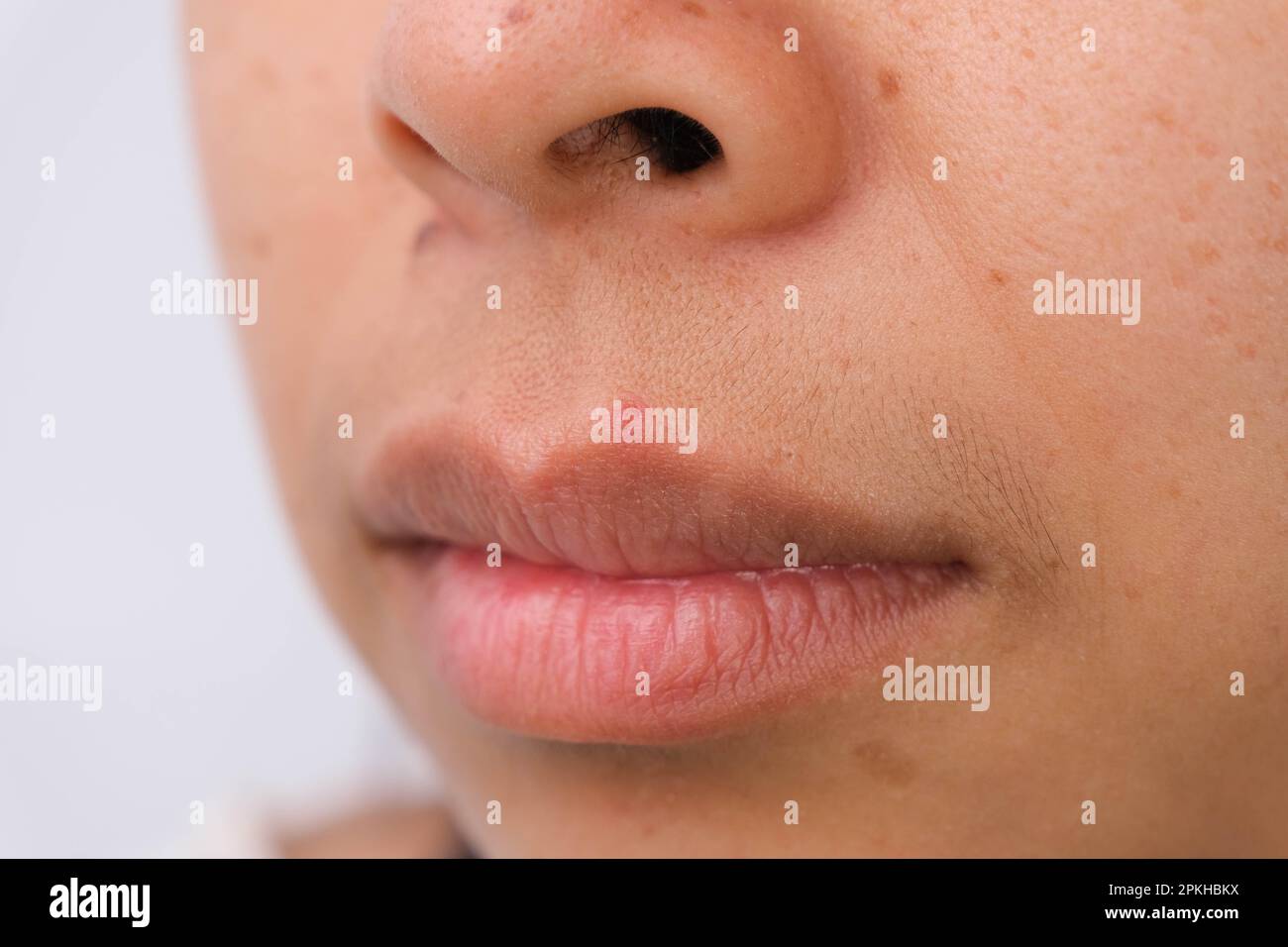 Close-up of freckles on Asian woman's face. Middle-aged woman with wrinkles, blemishes, dark spots, freckles, dry skin on her face. Skin care problems Stock Photo