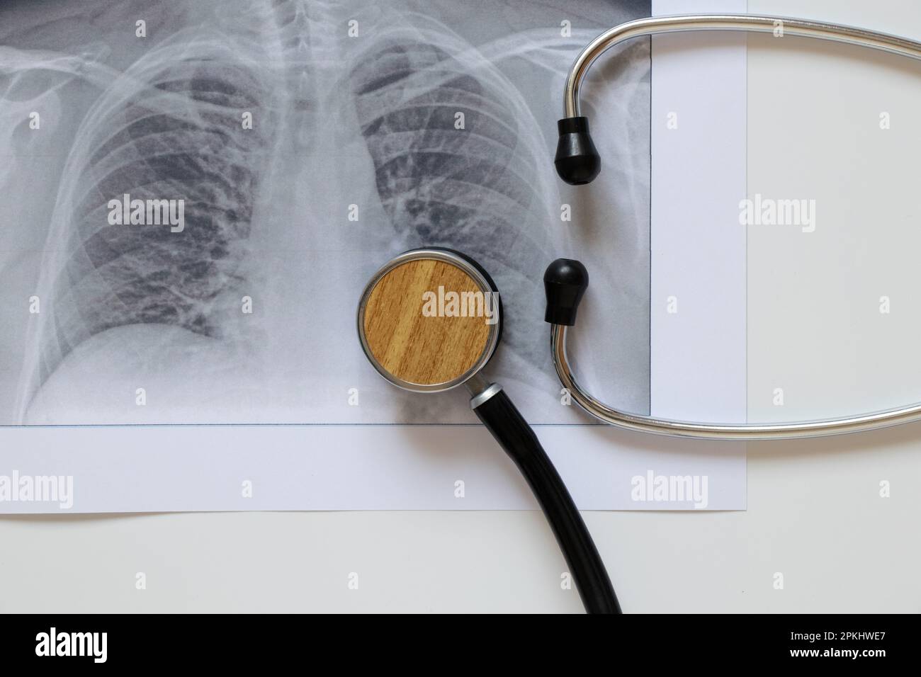 Fluorographic image of the lungs on paper and a stethoscope, healthy lungs of a man for a routine examination Stock Photo