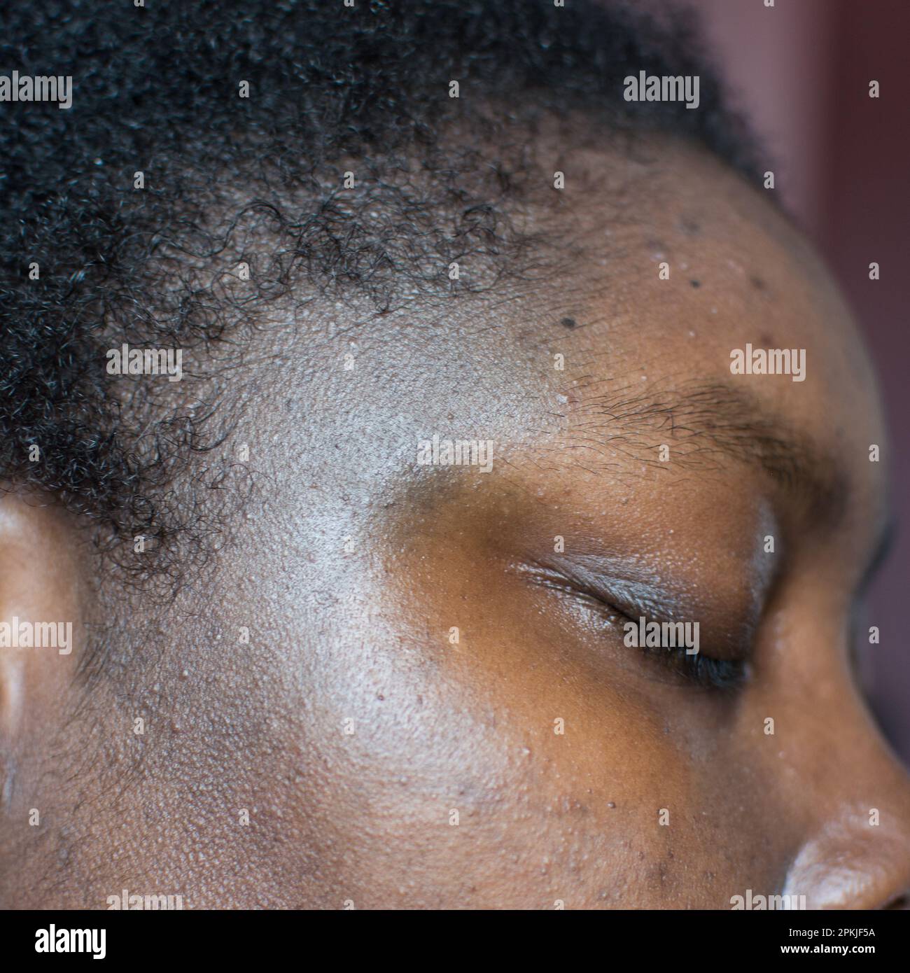 Brown skin with dark spots, hyperpigmentation on brown skin, african