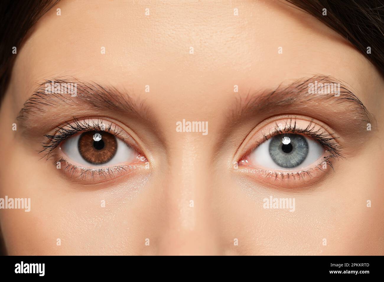 Woman with beautiful eyes of different colors, closeup. Heterochromia iridis Stock Photo