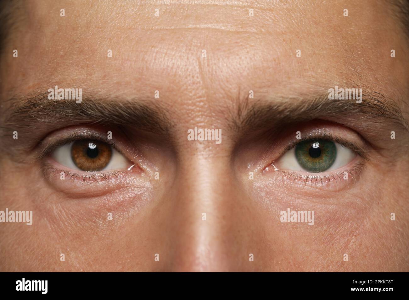 Man with beautiful eyes of different colors, closeup. Heterochromia iridis Stock Photo