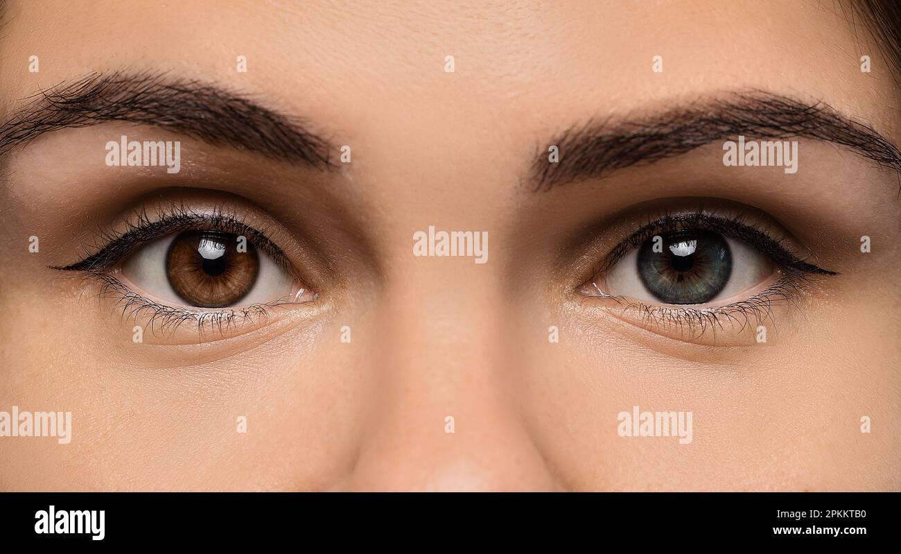 Woman with beautiful eyes of different colors, closeup. Heterochromia iridis Stock Photo