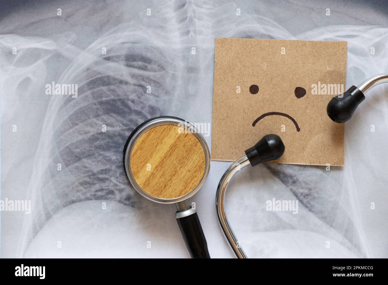 A fluorographic image of the lungs on paper and a stethoscope and a sad emoticon are drawn on paper, health and diagnostics, sadness Stock Photo