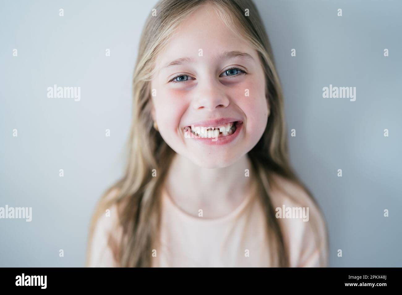 Happy young girl without teeth smiling Stock Photo - Alamy