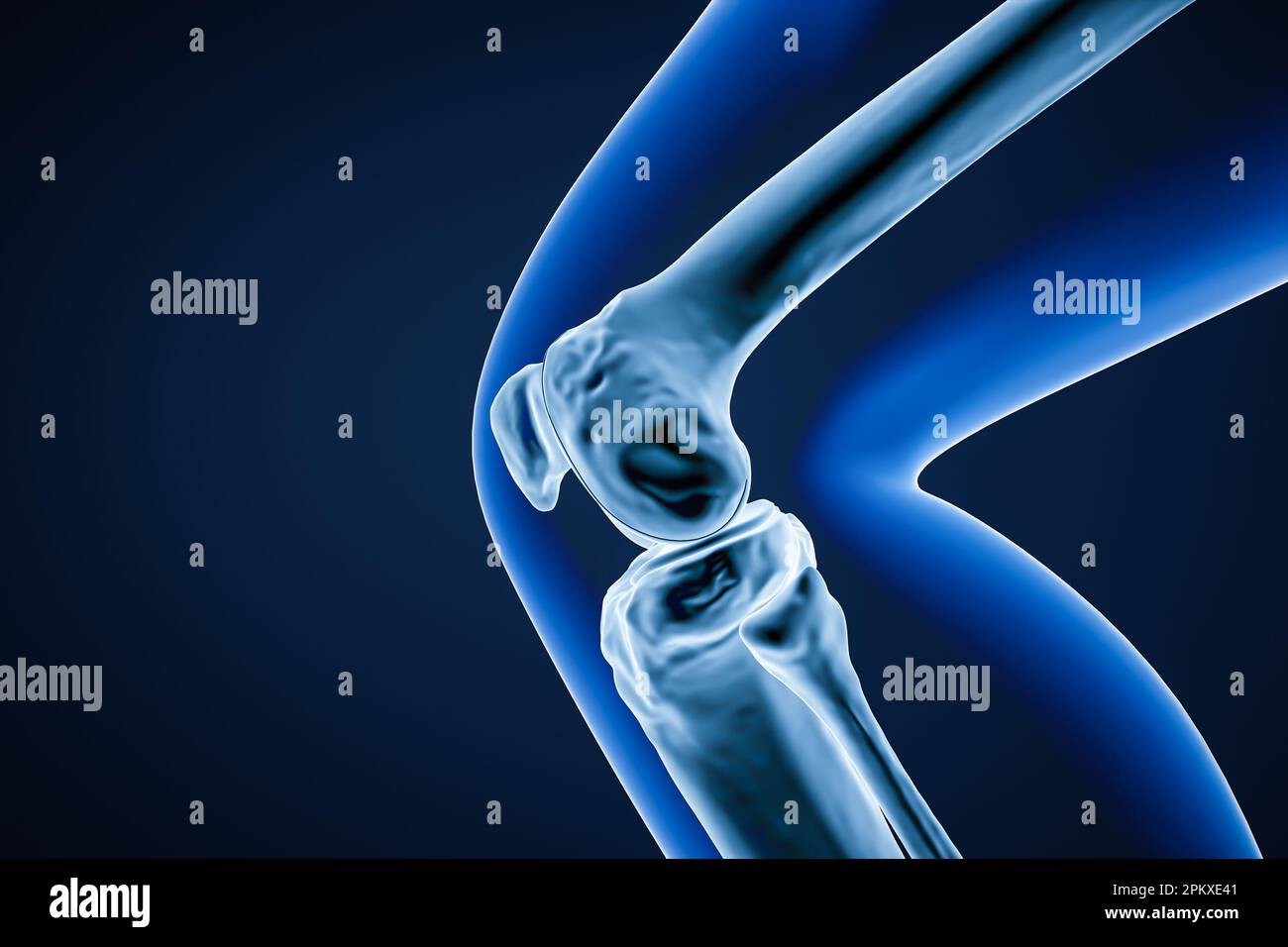 Close-up Profile Or Lateral View Of The Knee Joint Bones 3D Rendering ...