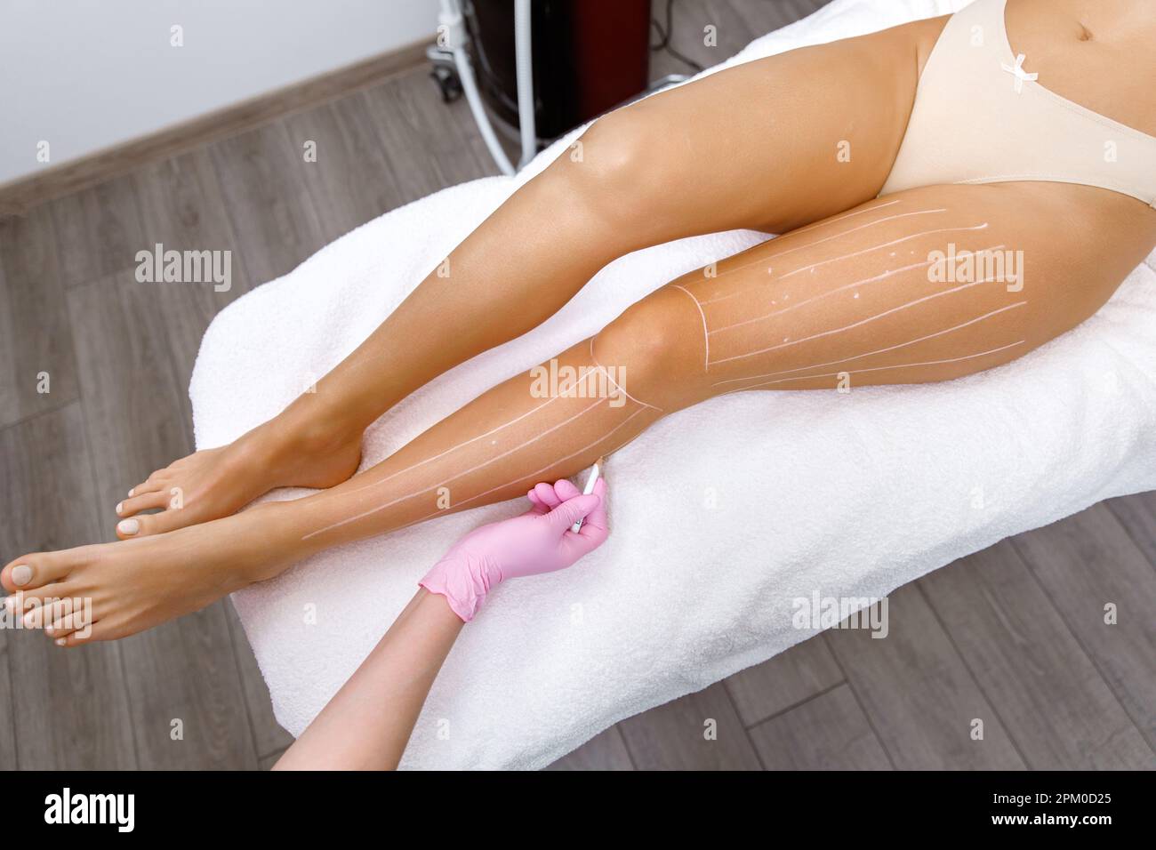 laser epilation,Rejuvenation Treatments, Preparation for laser hair ...