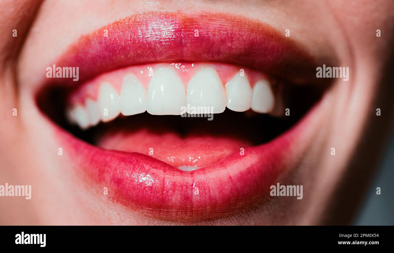 Smile teeth. Laughing woman mouth with great teeth close up. Healthy white teeth. Closeup of