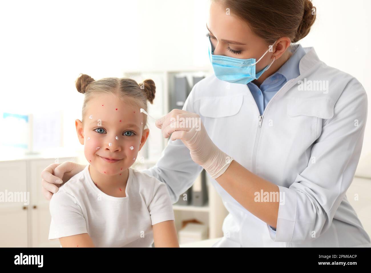 Chickenpox Doctor Doctor applying cream onto skin of little girl with chickenpox in ...