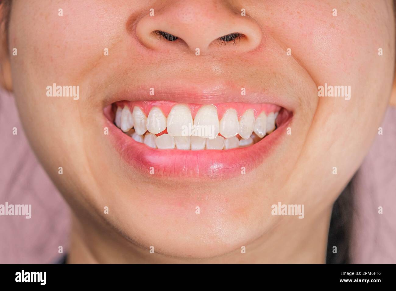 Close-up of front view of happy asian woman smiling broadly revealing her beautiful white teeth isolated on pink background. Stock Photo