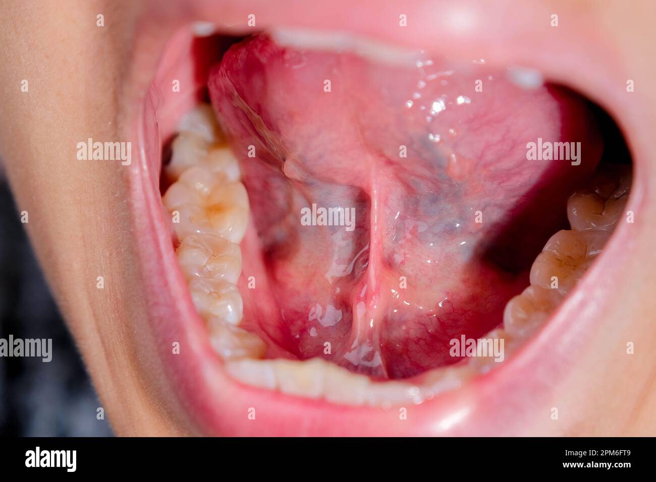 Closeup of the lower jaw, hard palate, soft palate, teeth and gums of