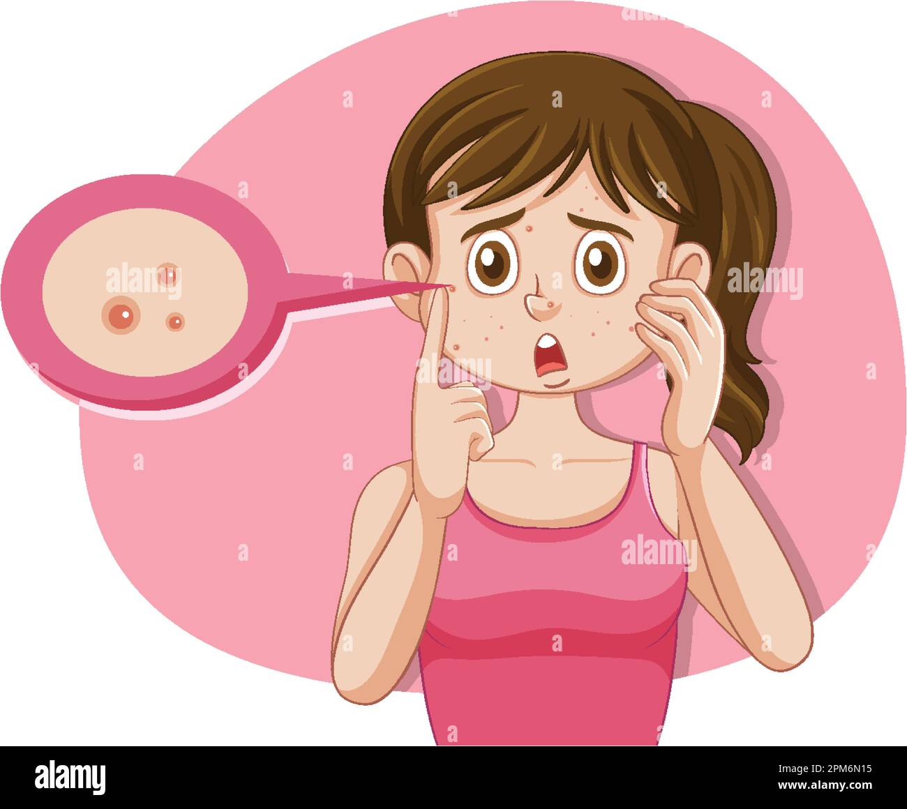 Puberty Girl Skin Problems During Puberty illustration Stock Vector