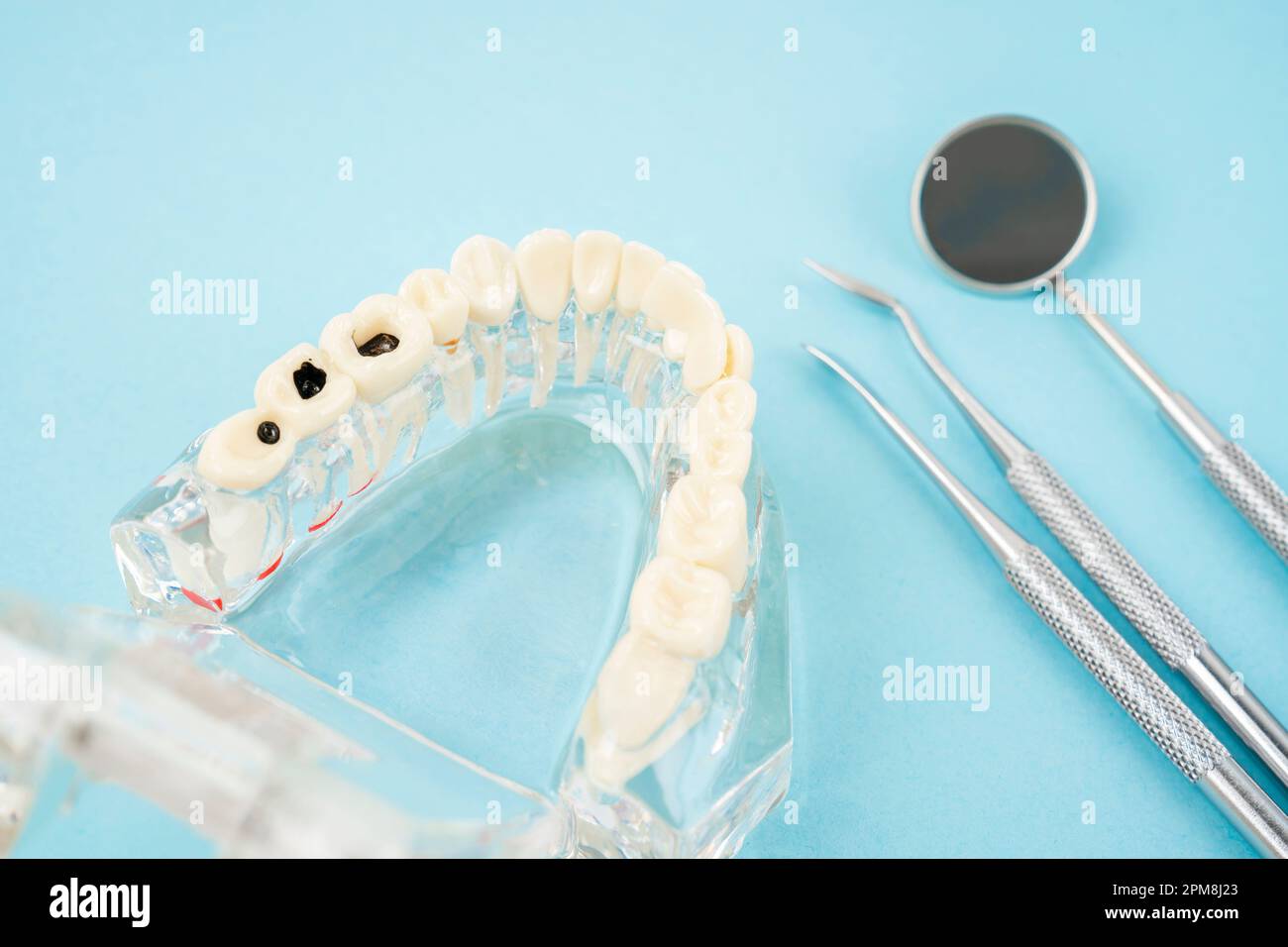 Healthy and decayed teeth model and mouth mirror, Dental concepts Stock