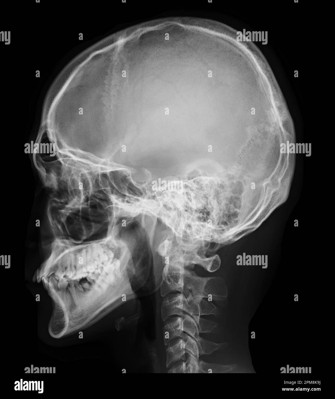 X Ray View Chart at Roger Monday blog