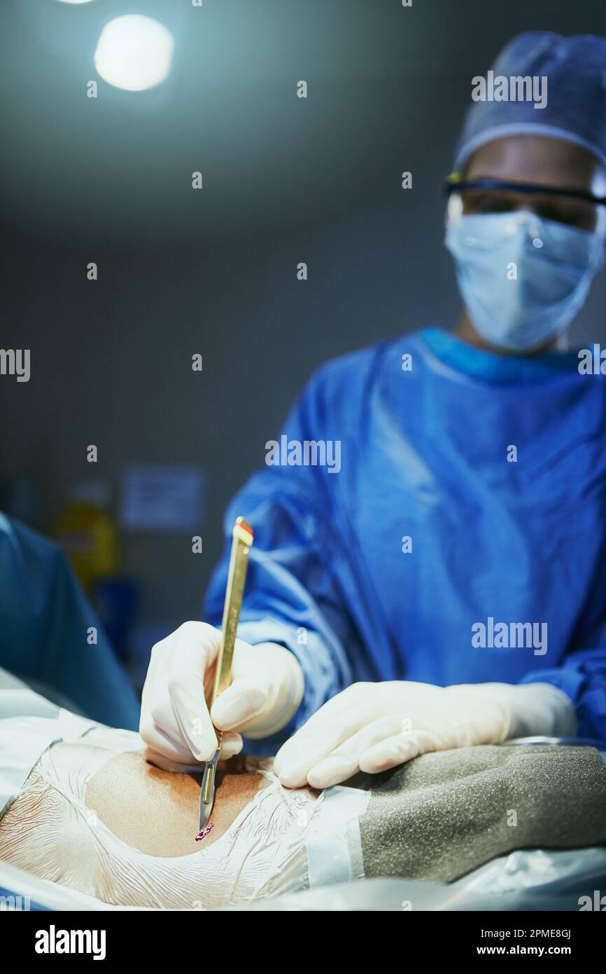 Natural incision hi-res stock photography and images - Alamy