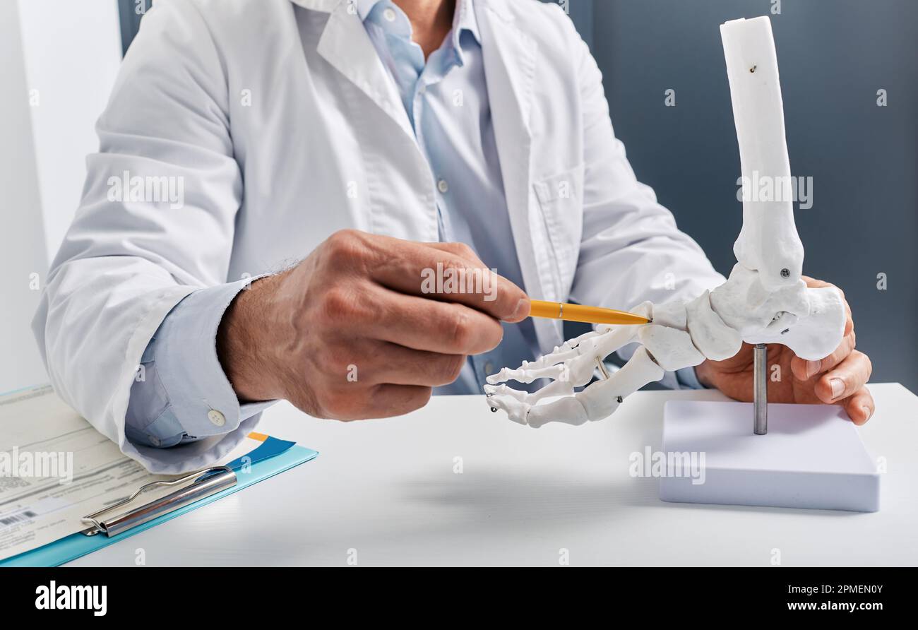 Anatomical foot skeleton model in doctor hands close-up, while consultation in orthopedic clinic. Traumatology, treatment of leg injuries Stock Photo