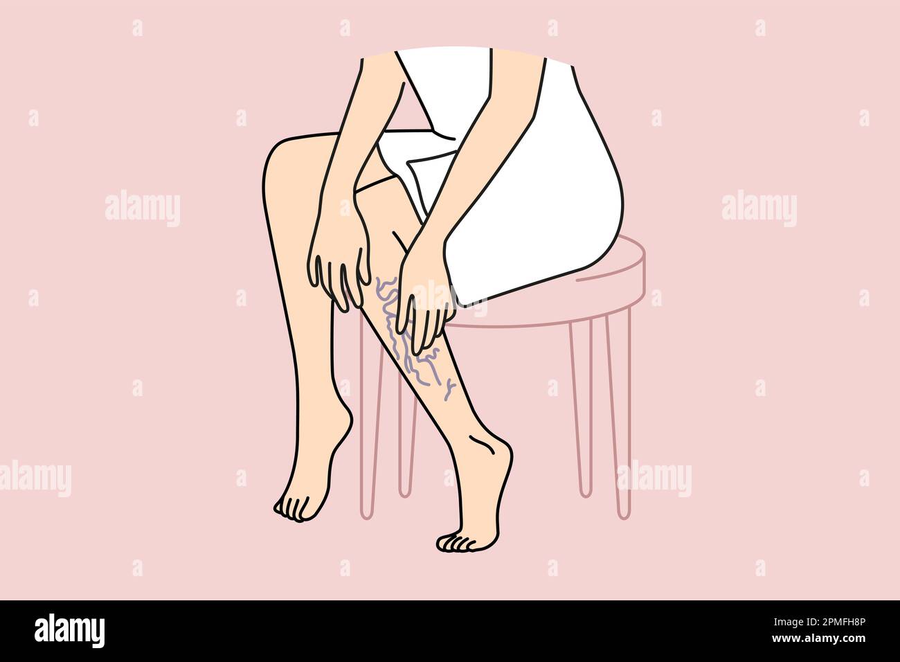 Woman touching legs with varicose veins. Female with vascular leg disease suffer from enlarged blood vessels. Vector illustration.  Stock Vector