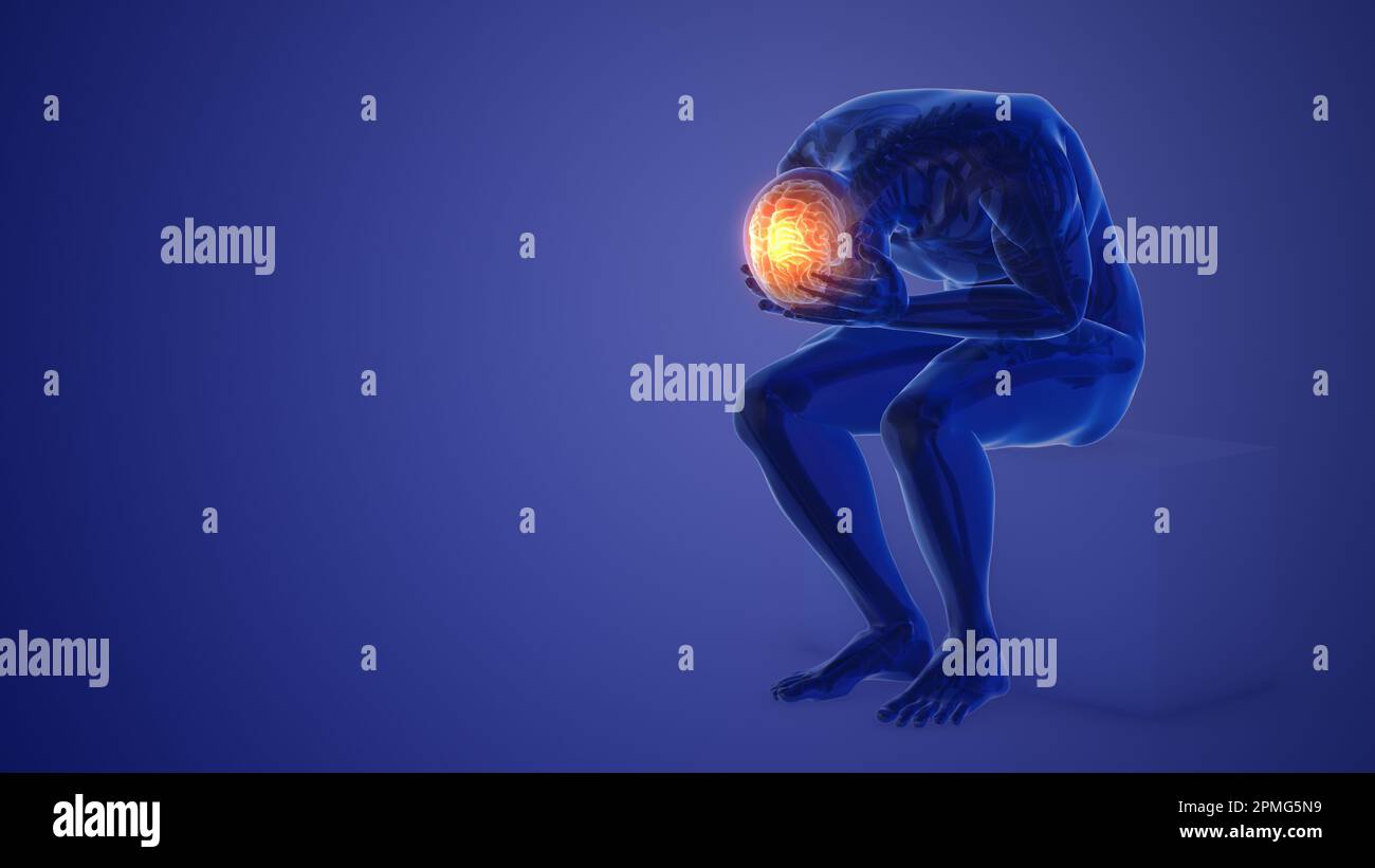3d human having severe headache or pain or migraine concept Stock Photo