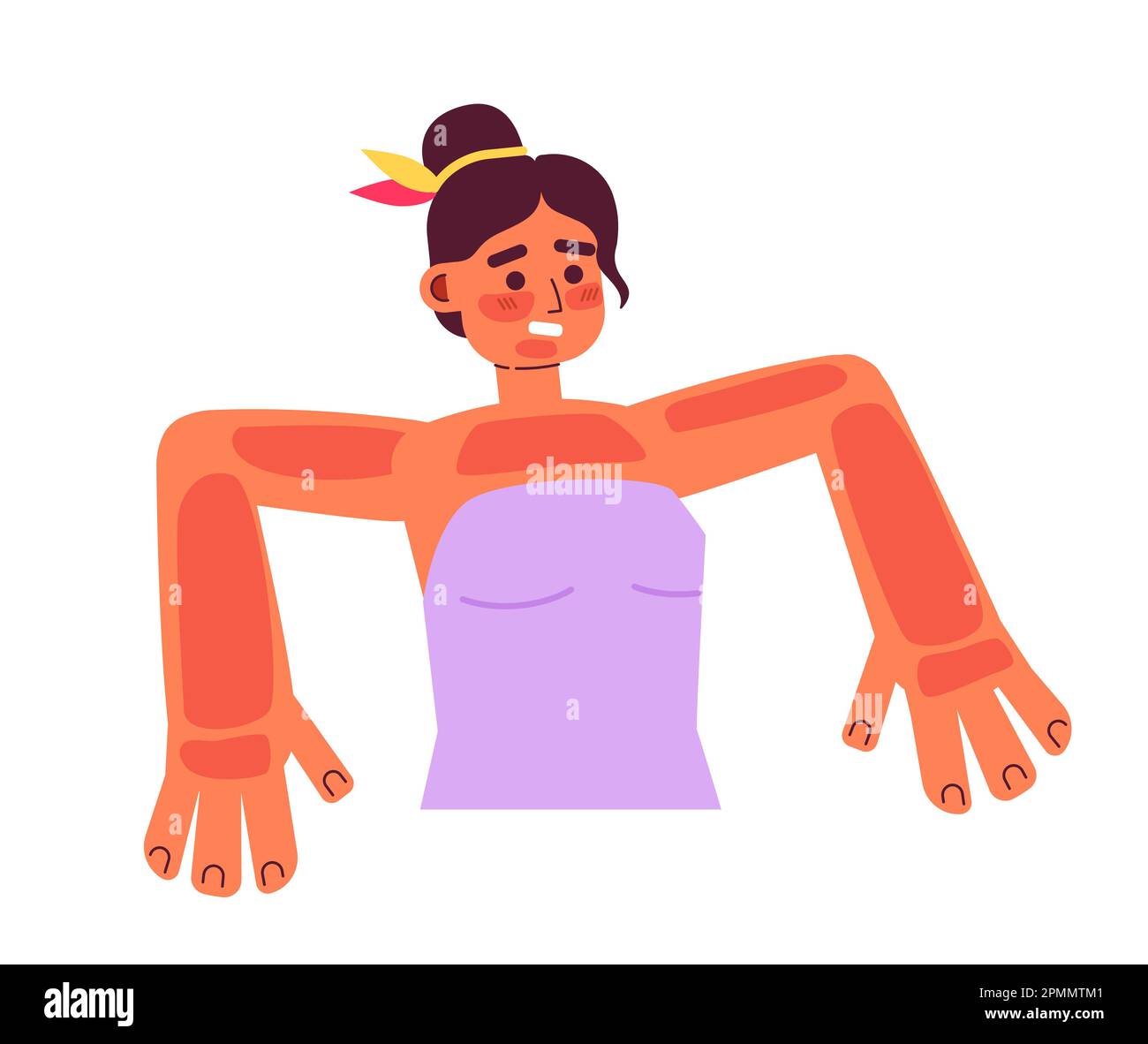 Young woman with severe sunburns semi flat colorful vector character Stock Vector