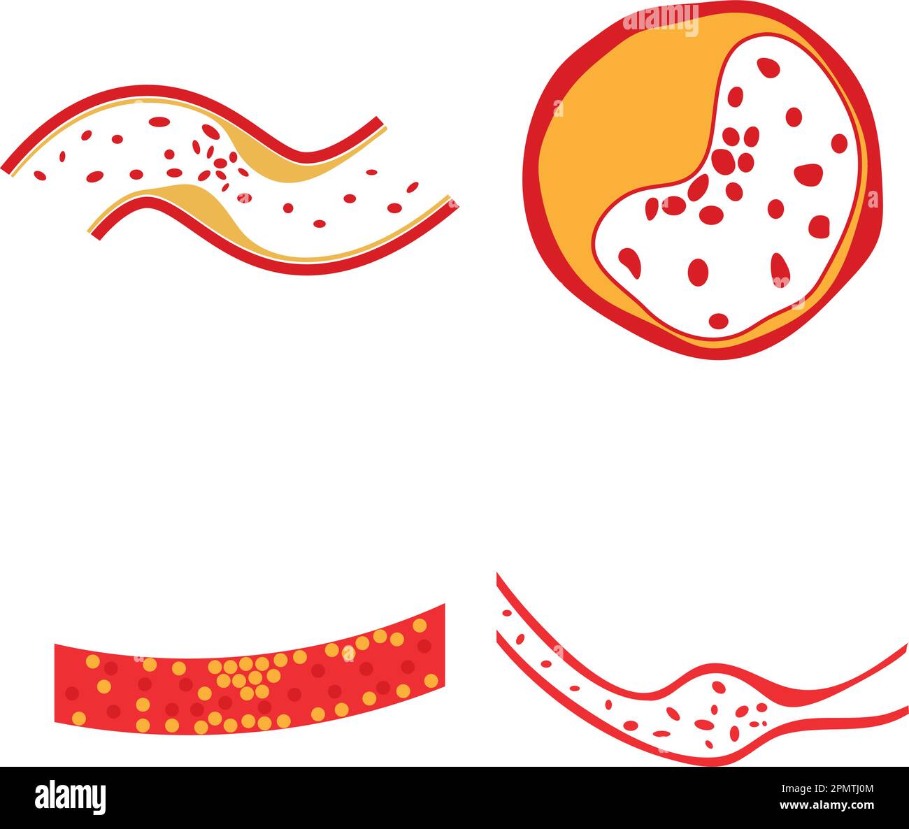 vector of cholesterol plaque illustratrion design Stock Vector