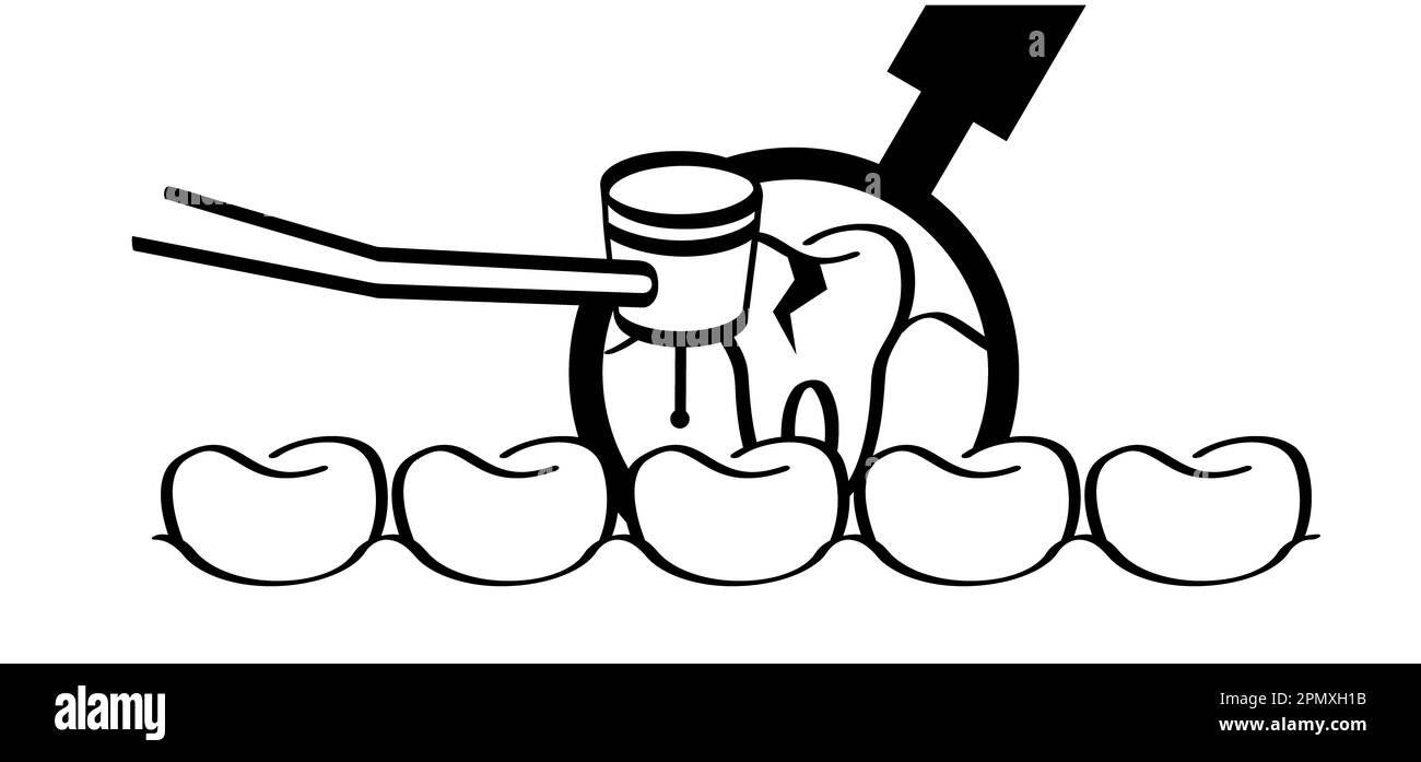 Dentist drill or dental drill for dental clinic. Cartoon tooth with